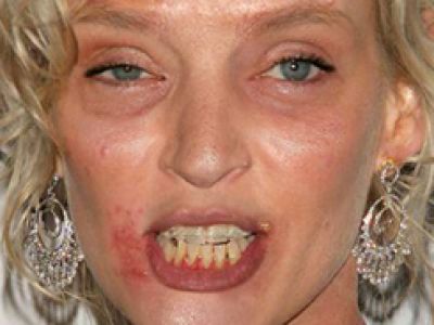 Tak wyglądają wizerunki przećpanych Celebrities