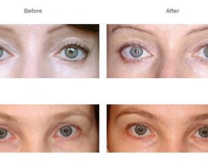 Serum o działaniu skalpela Dermatopoietin